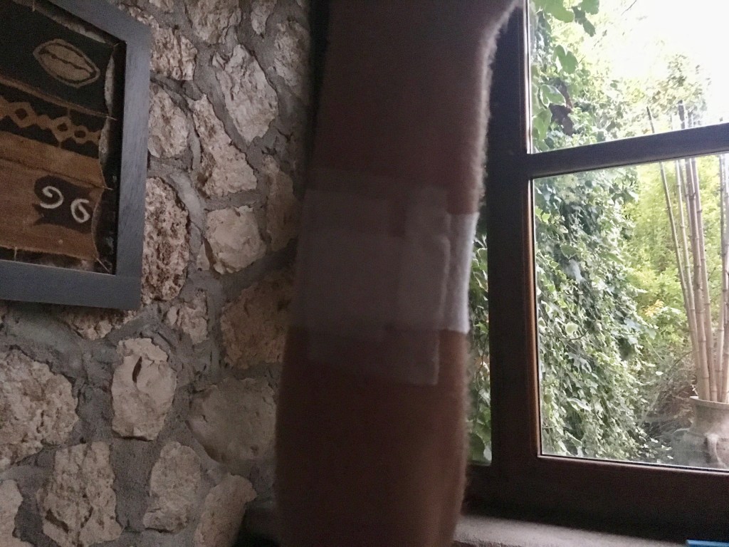 Ma voi siete mai stati morsi da un gabbiano ??? Il Ciccio si !!!!